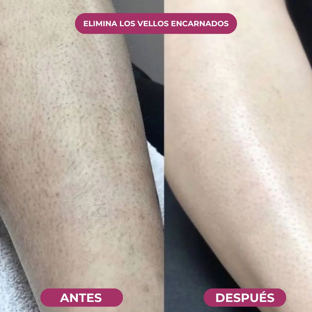 Aceite Godetica™ - Menos Vello, Más Suavidad