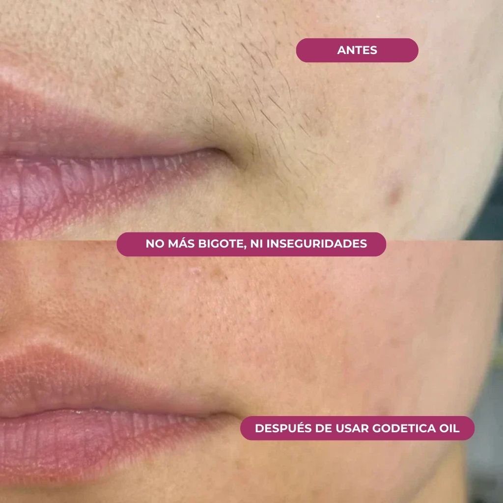 Aceite Godetica™ - Menos Vello, Más Suavidad
