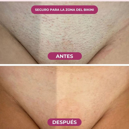 Aceite Godetica™ - Menos Vello, Más Suavidad